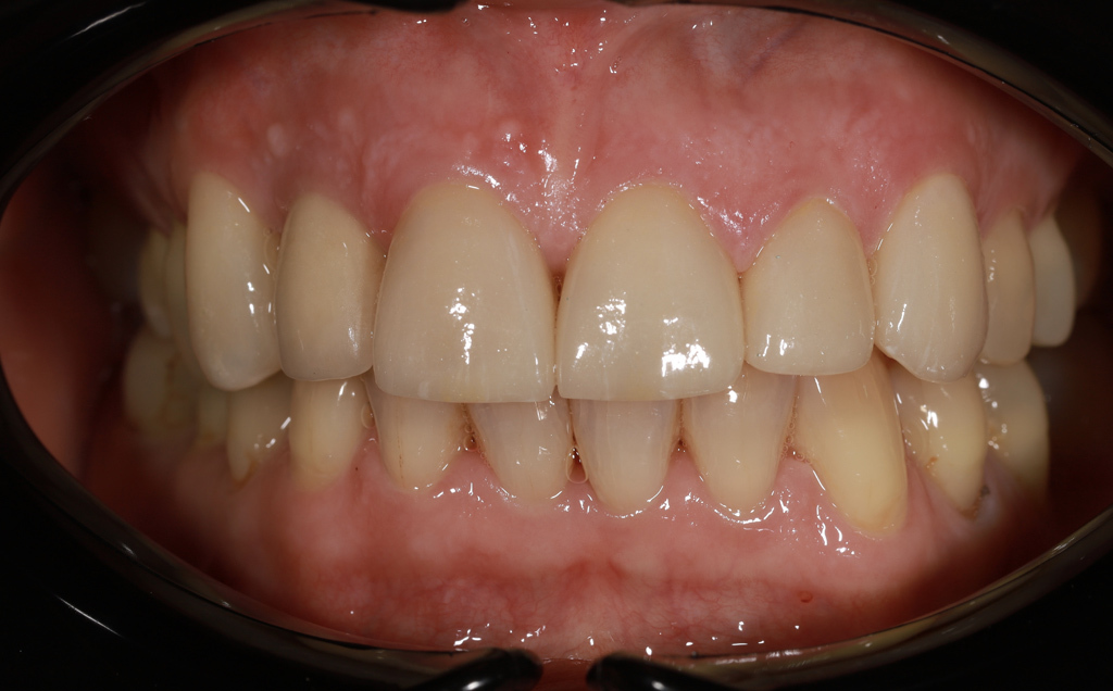 Zdjęcie po metamorfozie