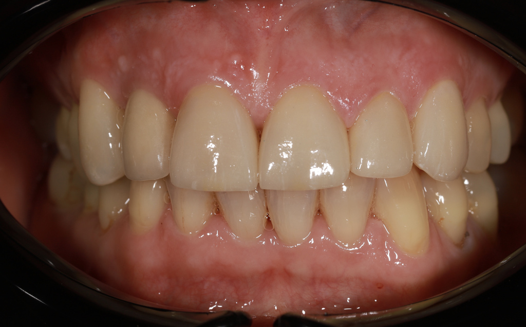 Zdjęcie po metamorfozie