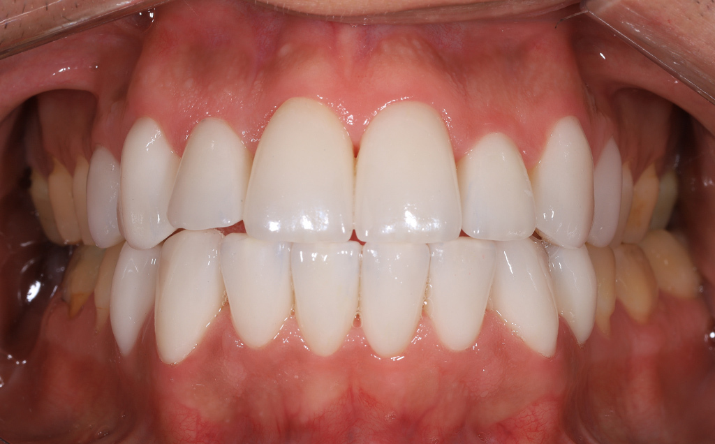 Zdjęcie po metamorfozie