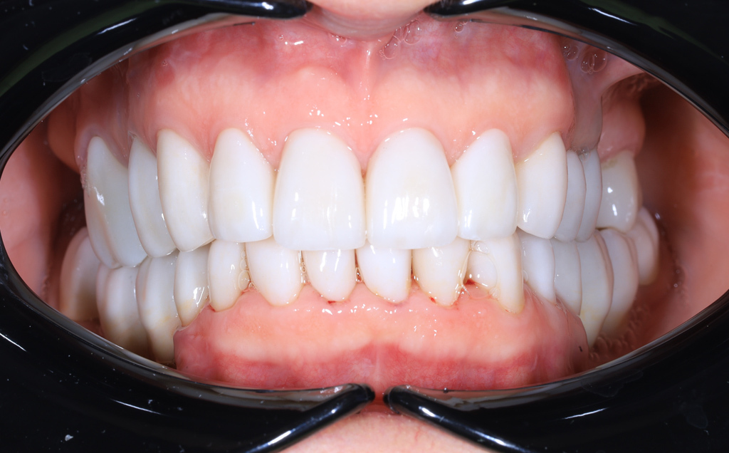 Zdjęcie po metamorfozie