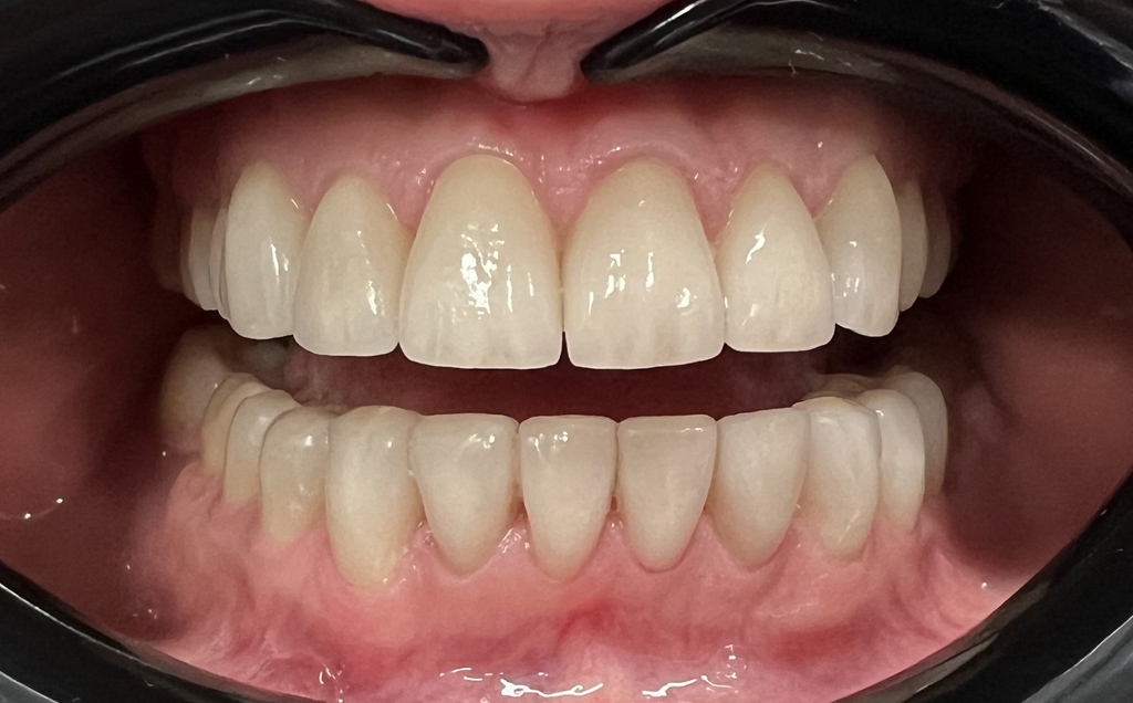 Zdjęcie po metamorfozie