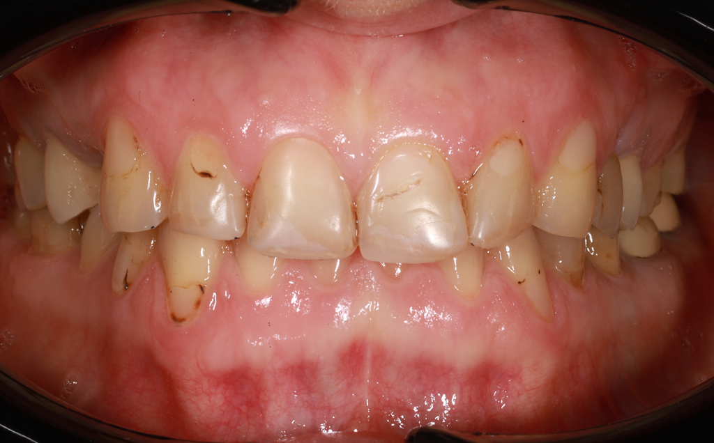 Zdjęcie przed metamorfozą