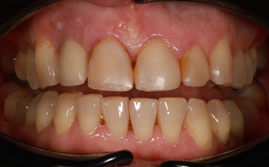 Zdjęcie przed metamorfozą