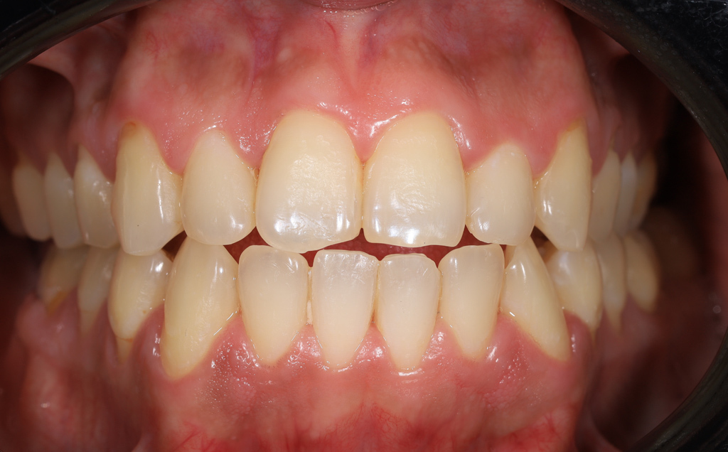 Zdjęcie przed metamorfozą