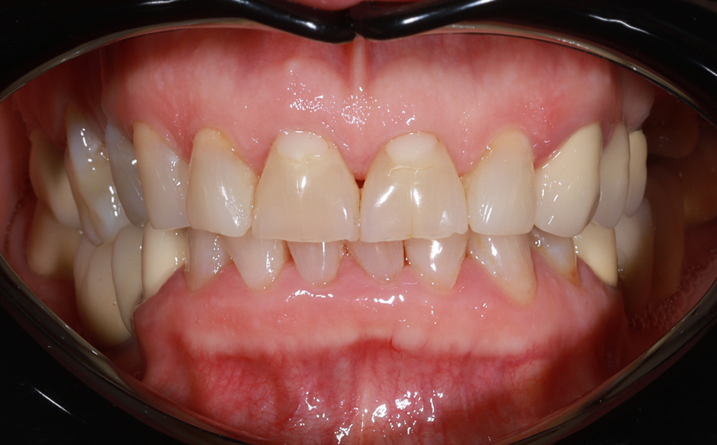 Zdjęcie przed metamorfozą