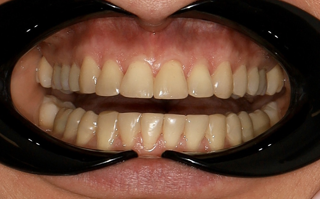 Zdjęcie przed metamorfozą