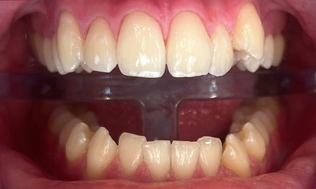 Zdjęcie po metamorfozie