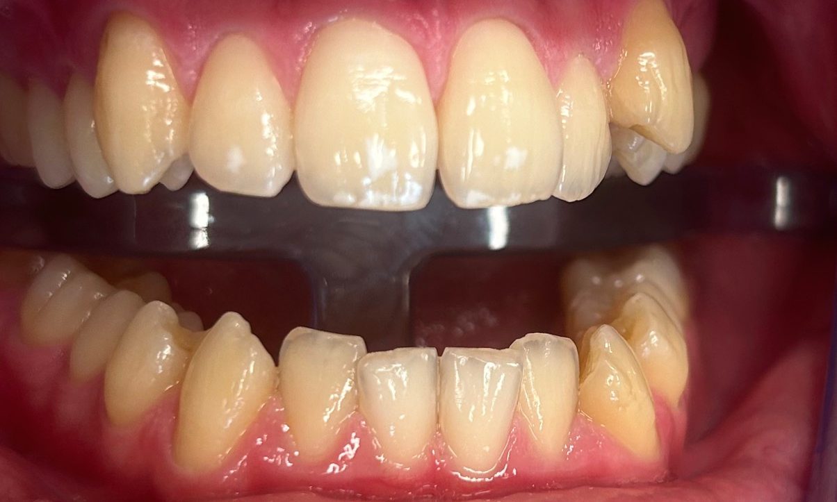 Zdjęcie przed metamorfozą