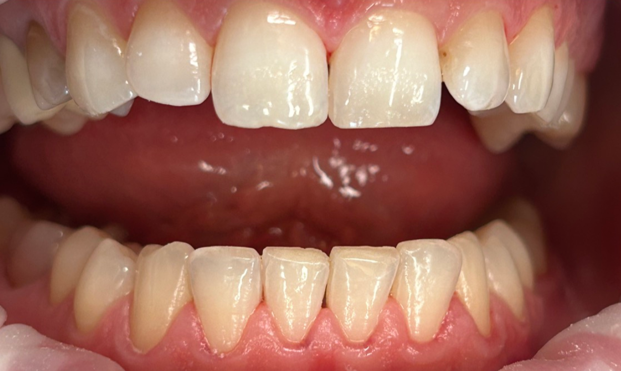 Zdjęcie po metamorfozie