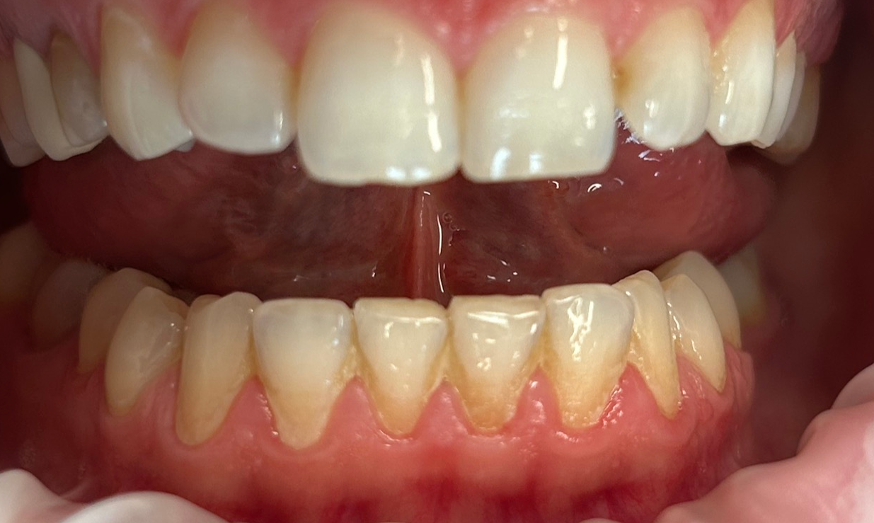 Zdjęcie przed metamorfozą