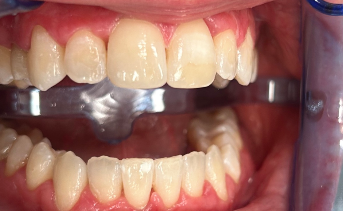 Zdjęcie po metamorfozie