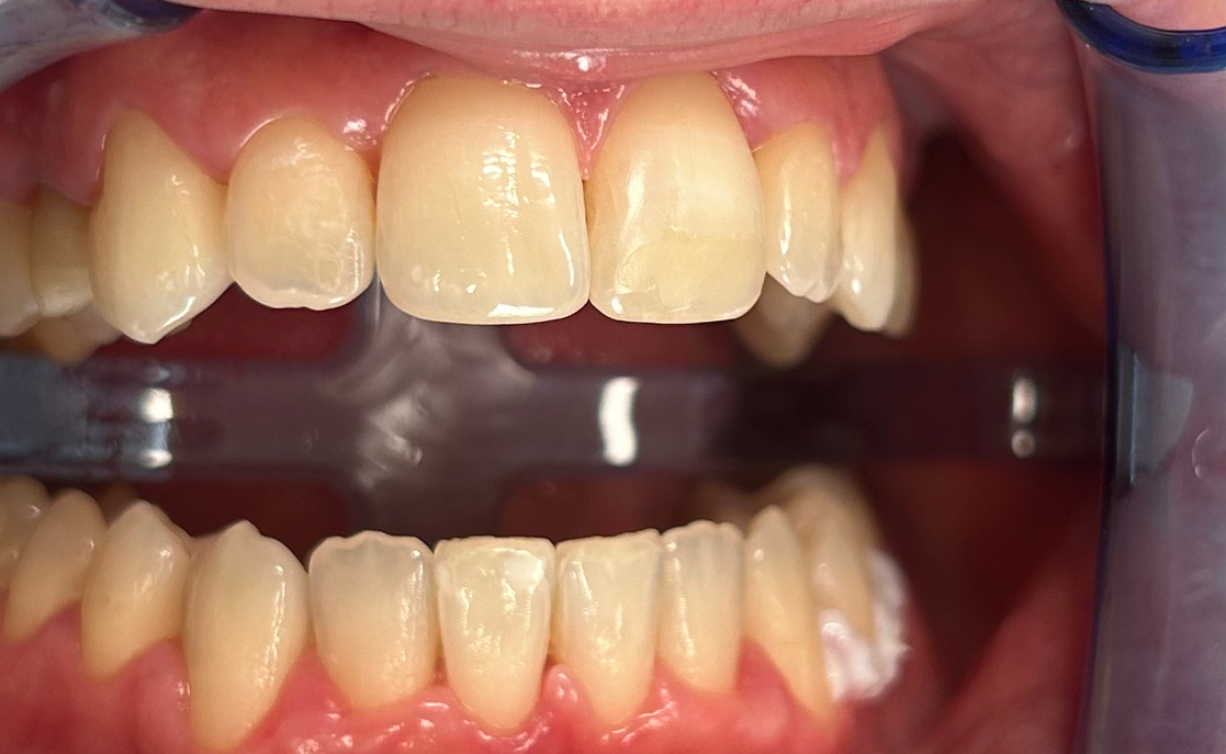 Zdjęcie przed metamorfozą