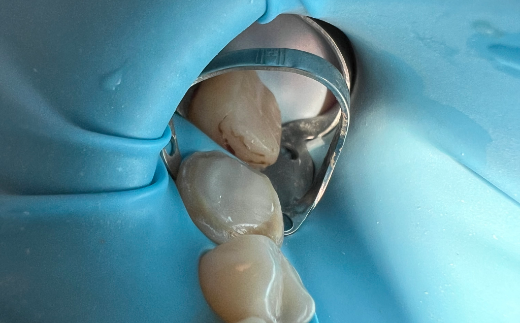 Zdjęcie po metamorfozie