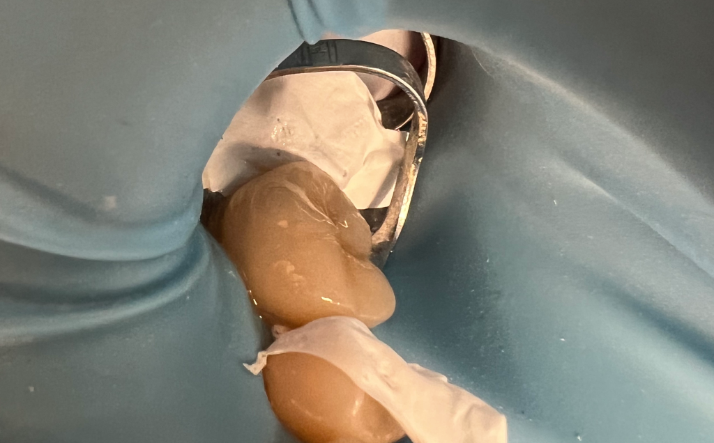 Zdjęcie przed metamorfozą