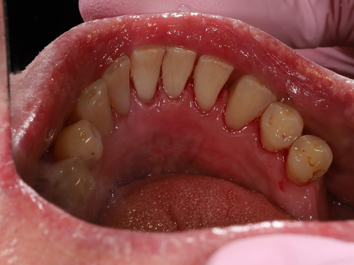 Zdjęcie po metamorfozie