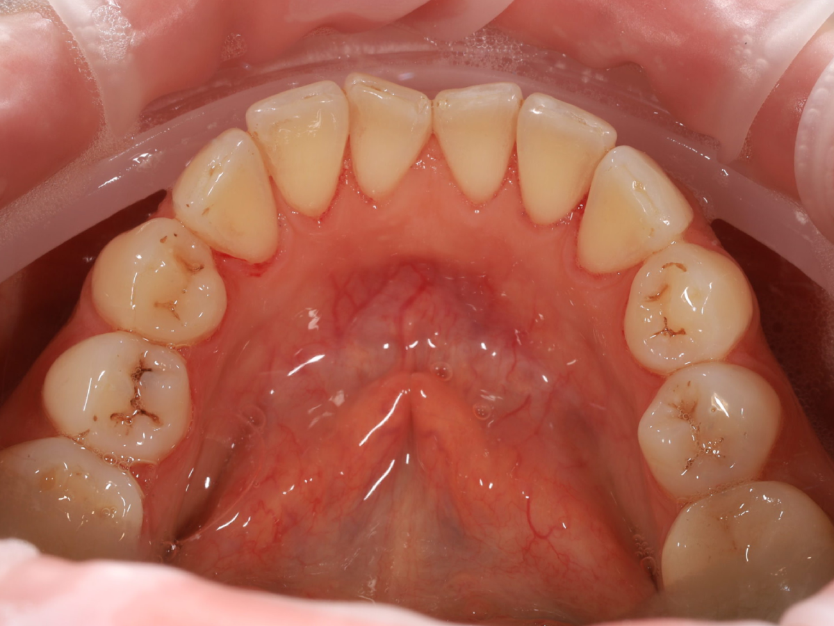 Zdjęcie po metamorfozie