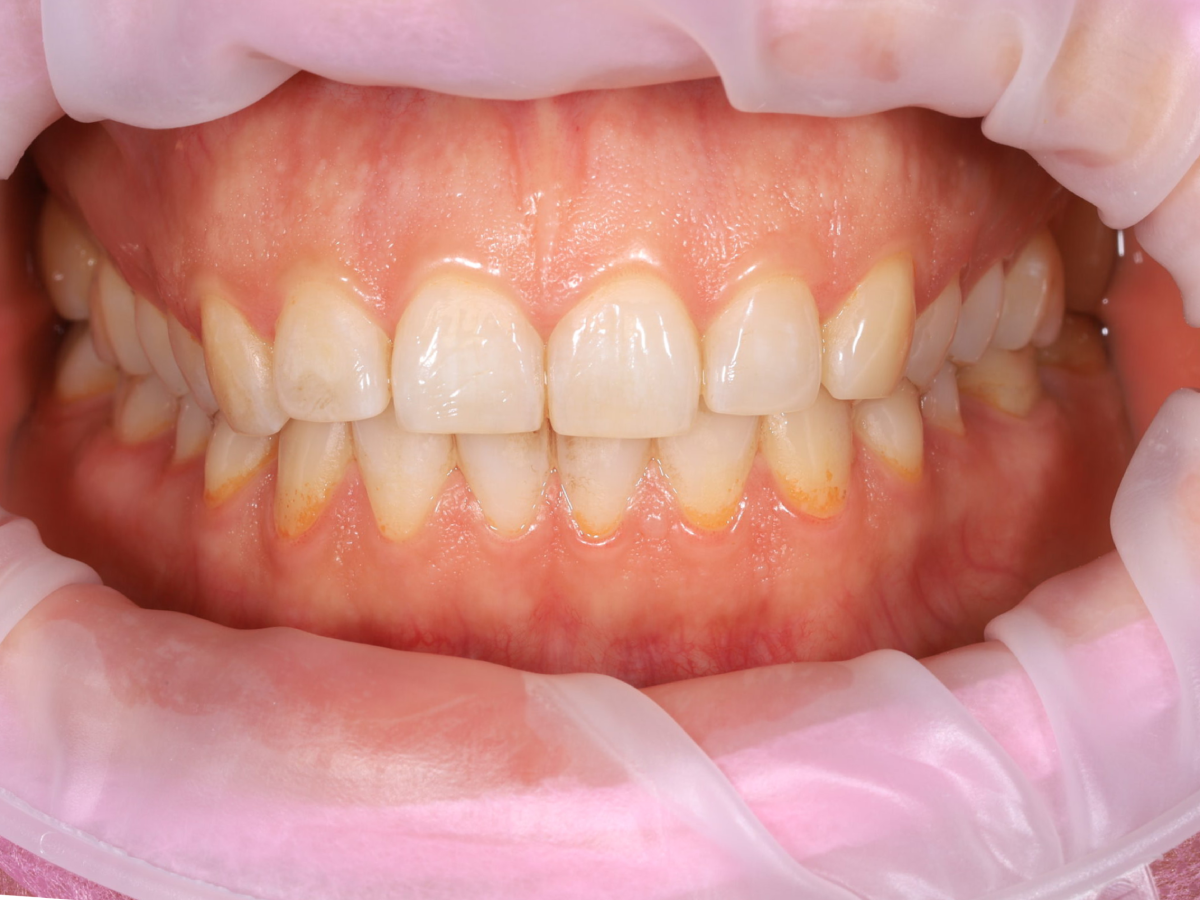 Zdjęcie po metamorfozie