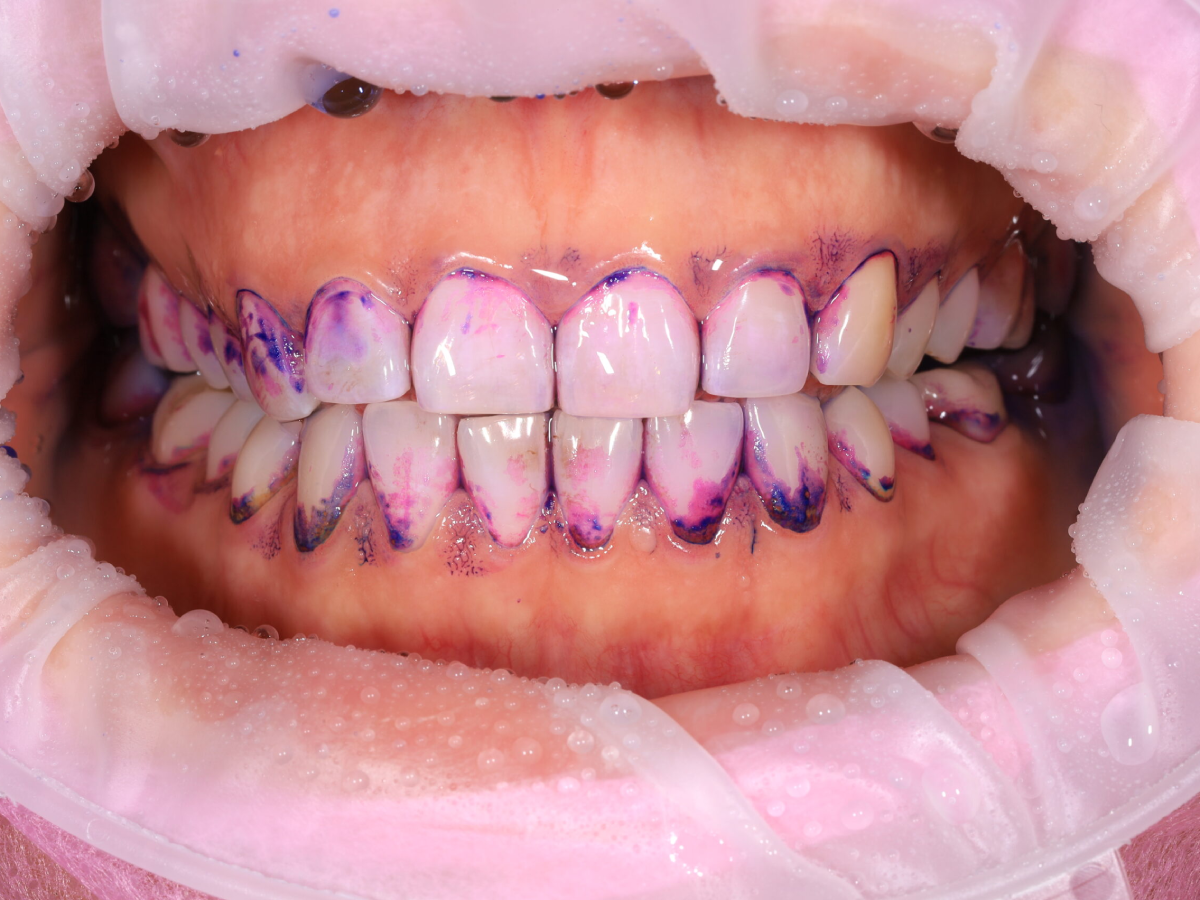 Zdjęcie przed metamorfozą